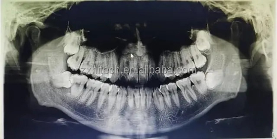 CT Dental 3D CBCT Equipamento Digital de Raios X China